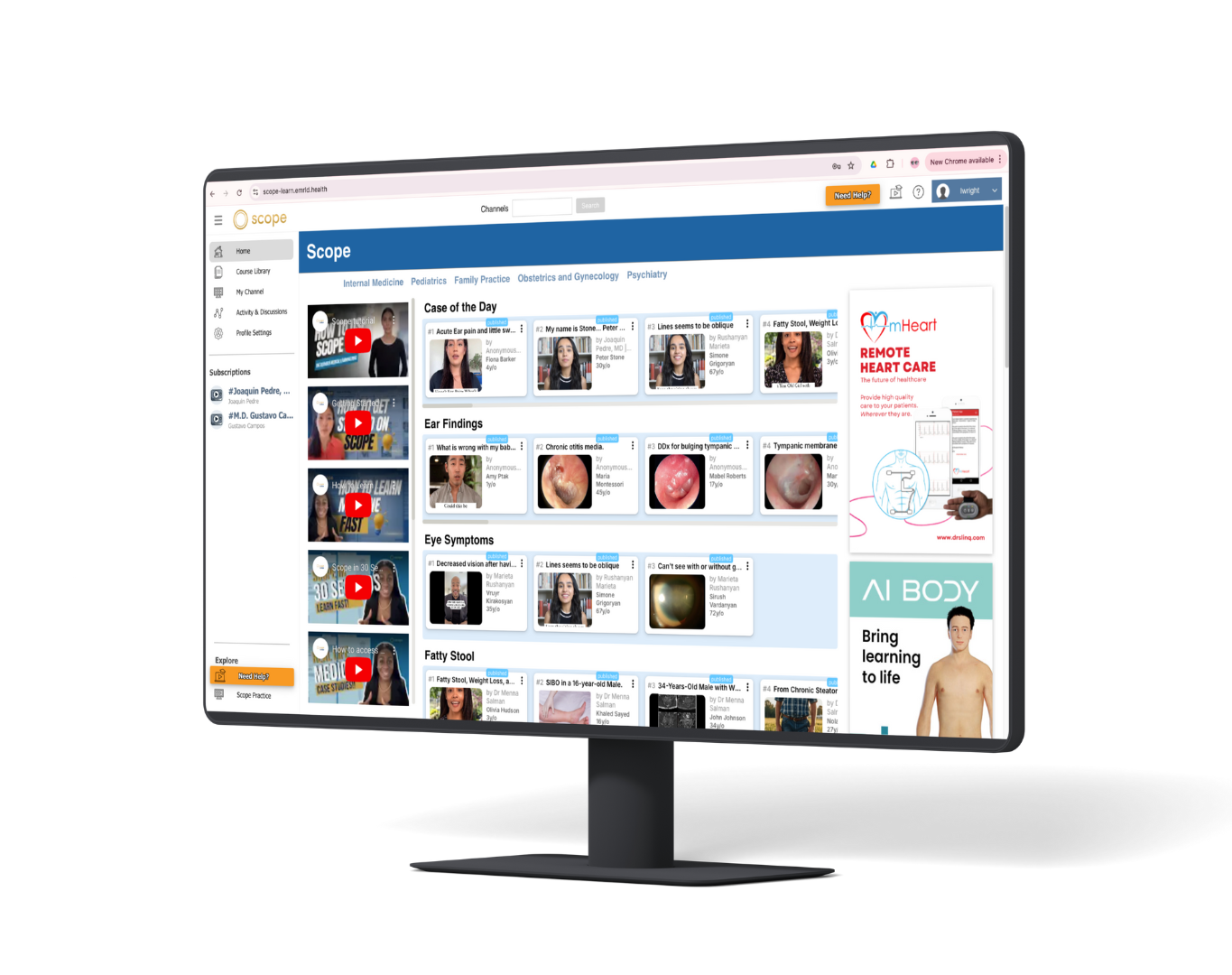 Scope app on large screen